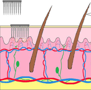 1. Micro-reedles indoloros: entregan activos sin agujas.