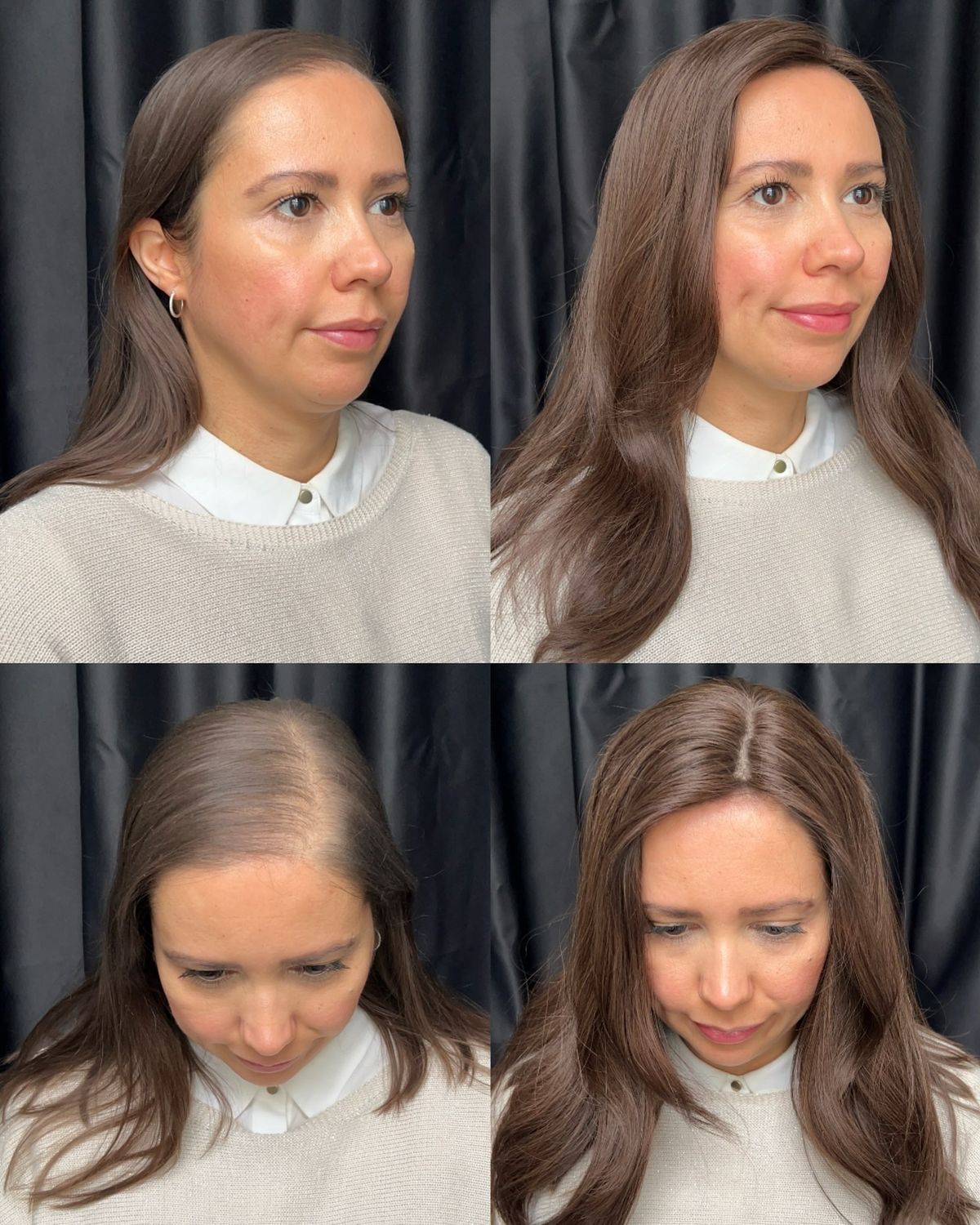 "Ya no sabía como disimular mis entradas, hasta ahora..."