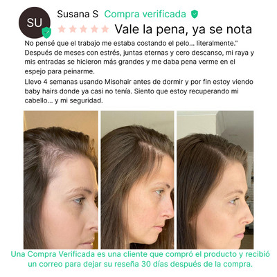 Misohair – Revitalizador Capilar Koreano