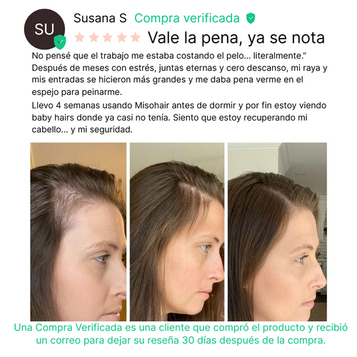 Misohair – Revitalizador Capilar Koreano