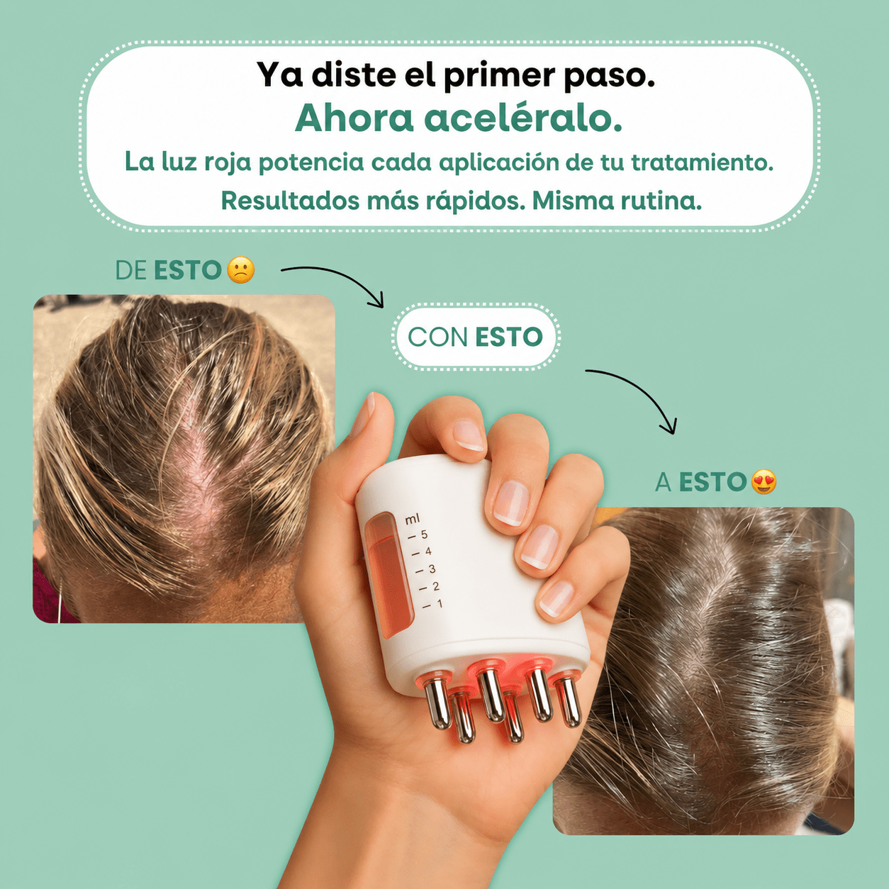 Microcorriente con Luz Roja Regenerativa - MISOHAIR