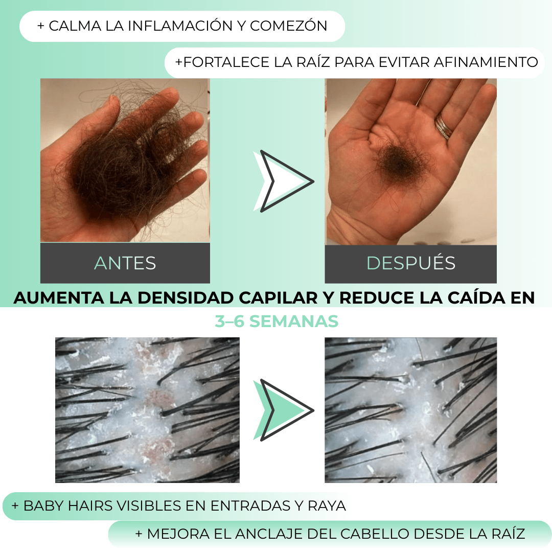 Misohair – Revitalizador Capilar Koreano - BRAVORA
