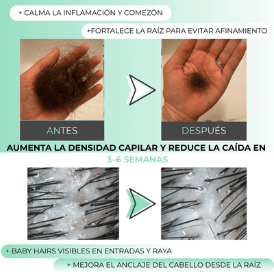 Misohair – Revitalizador Capilar Koreano - BRAVORA