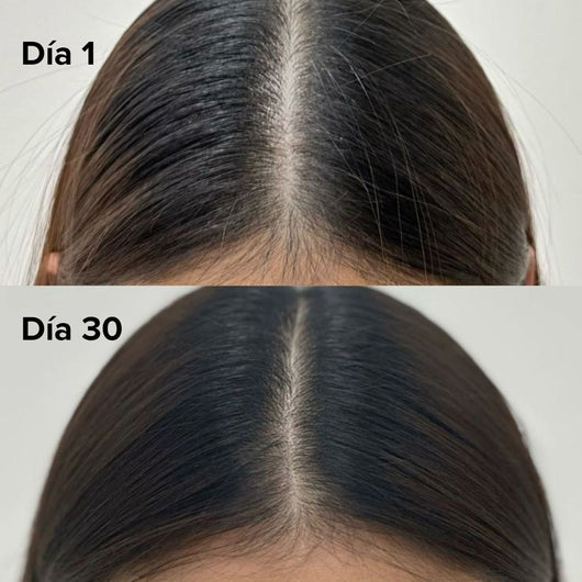 Misohair – Revitalizador Capilar Koreano