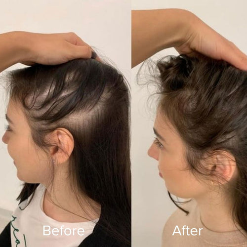 Misohair – Revitalizador Capilar Koreano