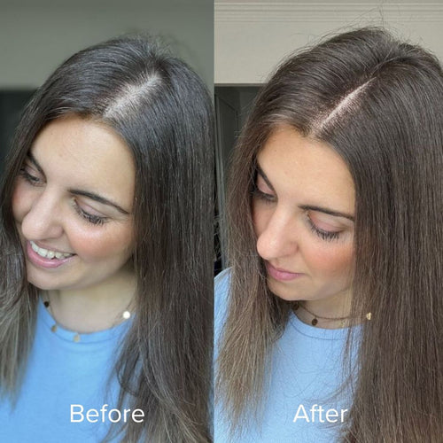 Misohair – Revitalizador Capilar Koreano