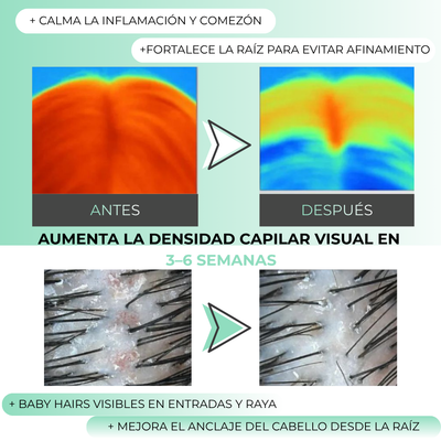 Misohair – Revitalizador Capilar Koreano