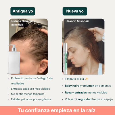 Misohair – Revitalizador Capilar Koreano